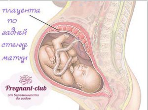 placenta-po-zadney.jpg [ время: 23.04.2014 16:52, размер: 34.25 Кб | Просмотров: 674 ]